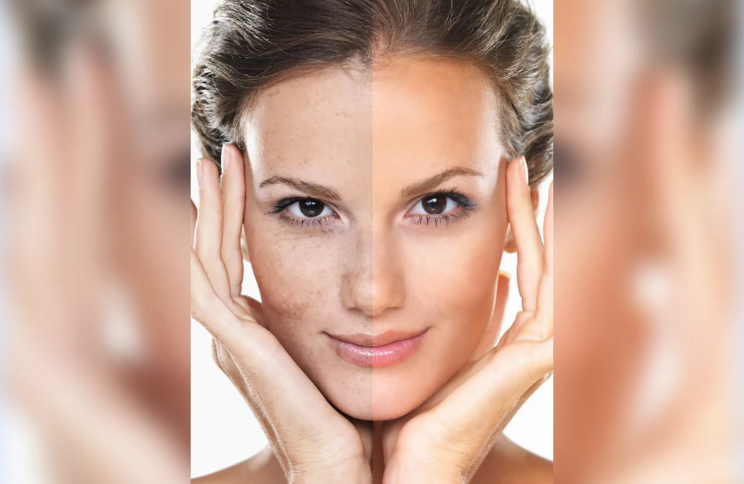 CIRCADIA® SWICH™ Dermal Rejuvenation Treatment bei einer professionellen Gesichtsbehandlung im PDB Aesthetic Room in Wiesbaden