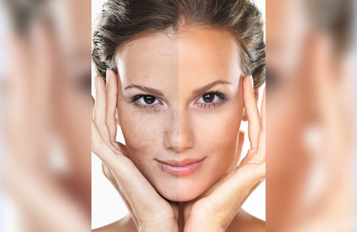 CIRCADIA® SWICH™ Dermal Rejuvenation Treatment bei einer professionellen Gesichtsbehandlung im PDB Aesthetic Room in Wiesbaden