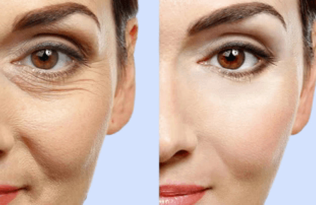 Hautverjüngung Behandlung für straffere und vitalere Haut im PDB Aesthetic Room Wiesbaden
