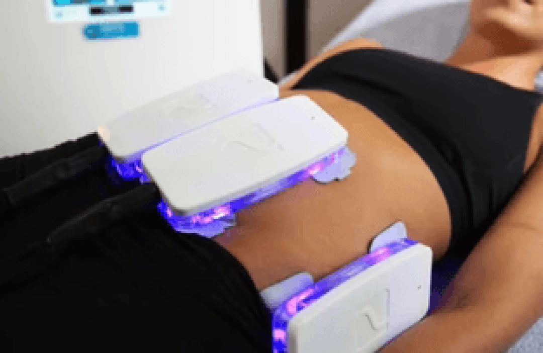 Kryolipolyse Behandlung zur gezielten Fettzellenreduktion im PDB Aesthetic Room Wiesbaden
