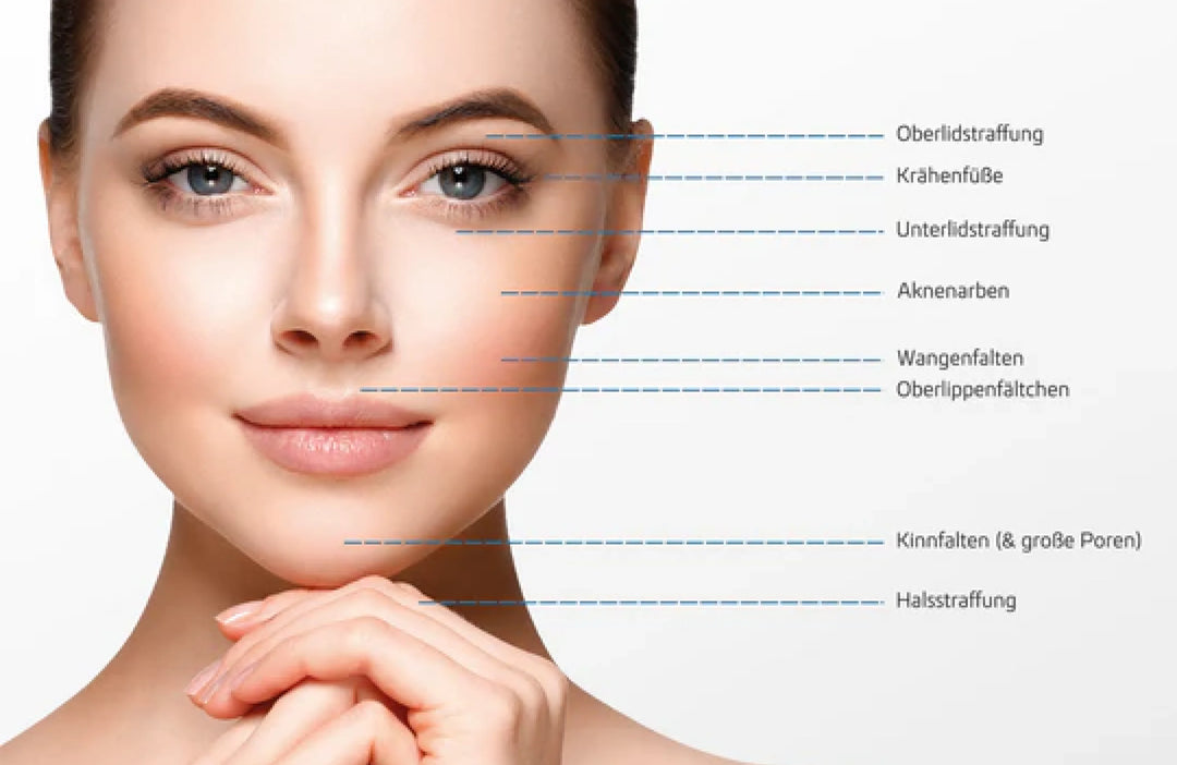 Nicht-operative Lifting-Behandlung zur Hautstraffung bei einer professionellen Anwendung im PDB Aesthetic Room in Wiesbaden