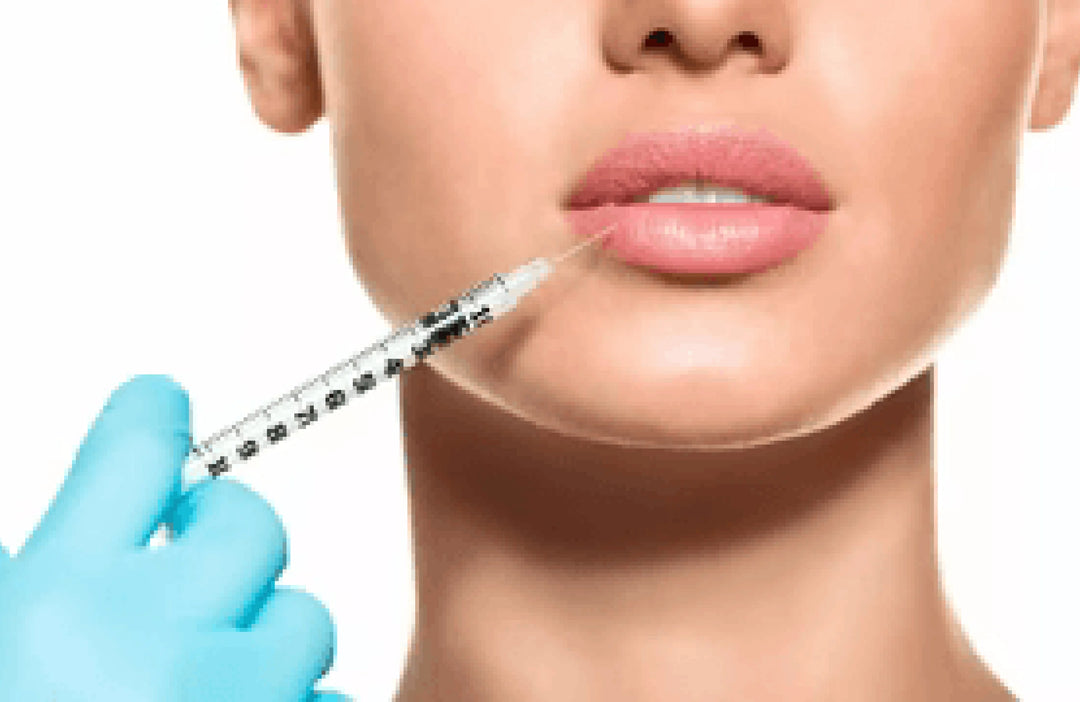 Lippenbehandlung mit Hyaluronsäure bei einer professionellen ästhetischen Anwendung im PDB Aesthetic Room in Wiesbaden