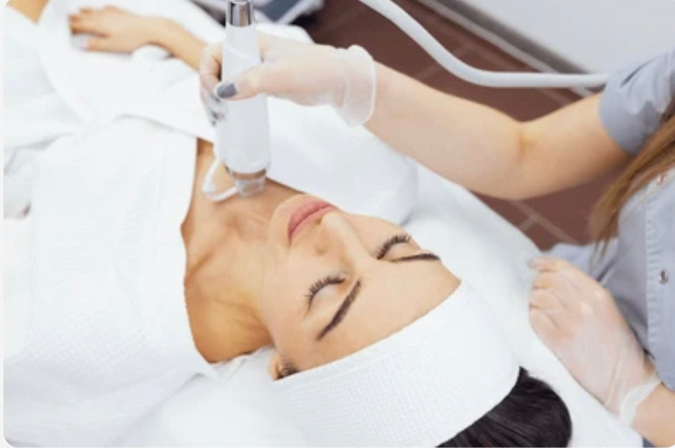 RF-Microneedling zur Hautstraffung und Hautverjüngung im PDB Aesthetic Room Wiesbaden
