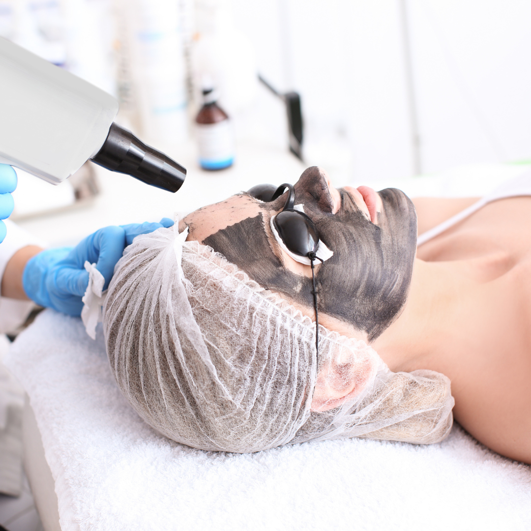 Carbon Laser Peeling zur Tiefenreinigung und Hautverfeinerung im PDB Aesthetic Room Wiesbaden
